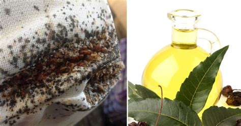 Neem Oil Benefits: Combat Bed Bugs, Repel Mosquitoes And More!