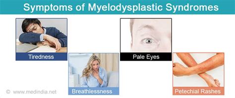 Myelodysplastic Syndrome - Types, Causes, Symptoms, Diagnosis, Treatment & Prognosis