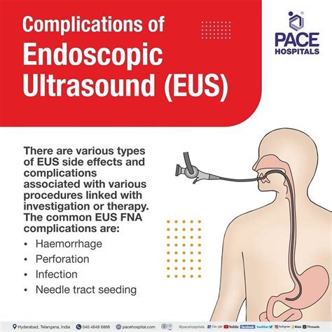 Endoscopic Ultrasound (EUS) in Hyderabad, India - Uses & Cost