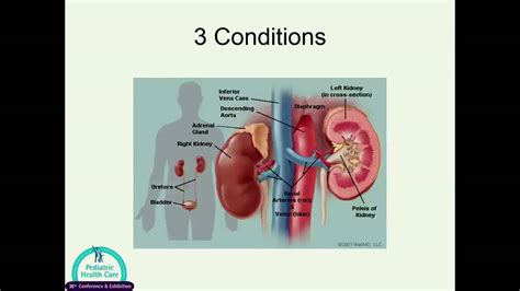 2015 Conference - Archived Session - Common Complaints in Pediatric Nephrology - YouTube