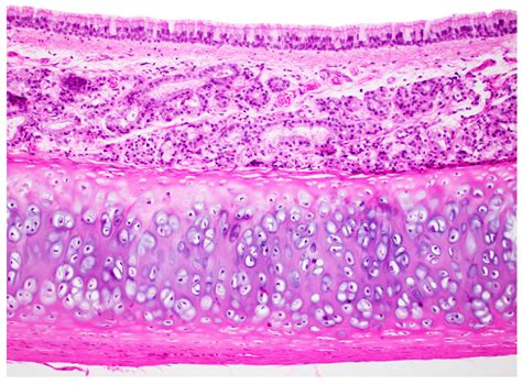 trachea histology Diagram | Quizlet