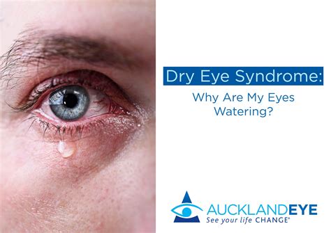 If you often have watery eyes, there could be are several possible reasons for this — from ...