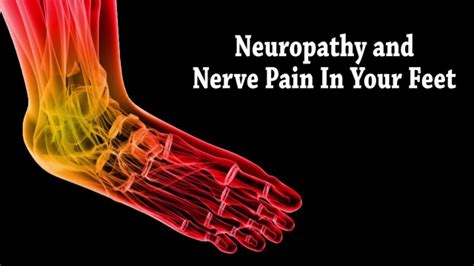 Peripheral Neuropathy - Kingwood, TX Foot Doctor