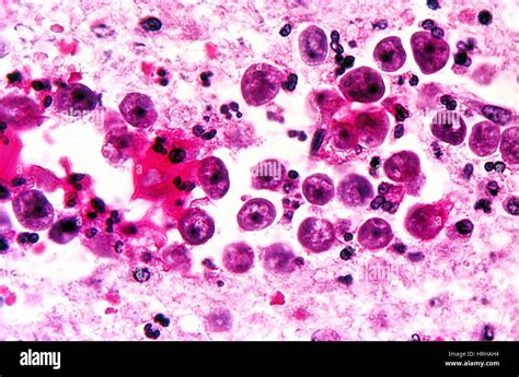 Naegleria Fowleri Microscope