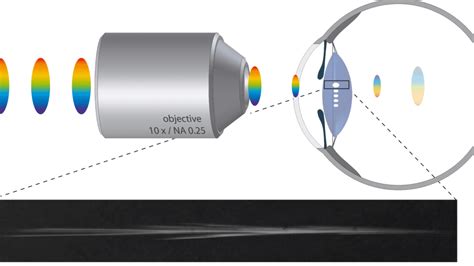 Medical Applications of Ultrashort Laser Pulses