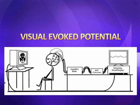 Visual evoked potential | PPT