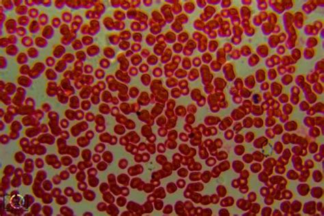 Under the Microscope: Red Blood Cells - Travis Hale (Photography and Science)