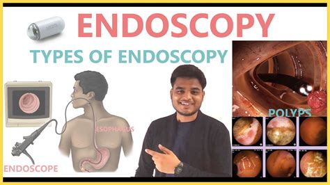 ENDOSCOPY | TYPES OF ENDOSCOPY & CAPSULE ENDOSCOPY || RJDS MEDIX - YouTube