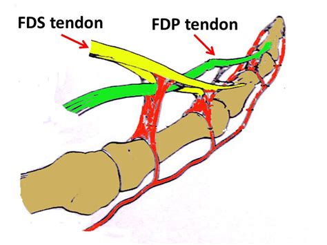 Fds And Fdp Tendons Test / Secondary Procedures for Failed Tendon ...