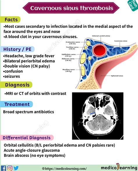 cavernous sinus thrombosis – MedicoLearning