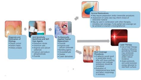 Dentin Hypersensitivity Treatment At Home - Captions Beautiful