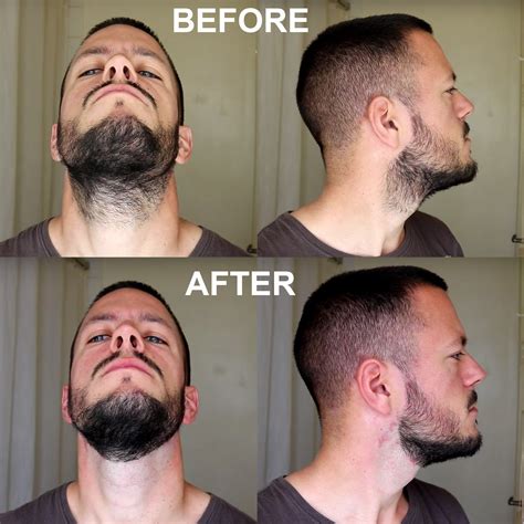 Aberlite Flexshaper Beard Neckline Guide - ABERLITE