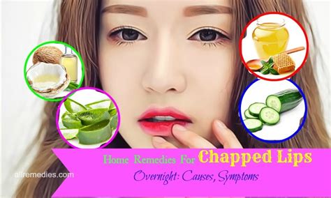 Top 15 Home Remedies For Chapped Lips Overnight: Causes, Symptoms