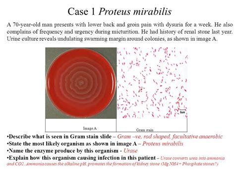 total Surgir Pilar proteus mirabilis colony morphology Pebish Espinoso lino