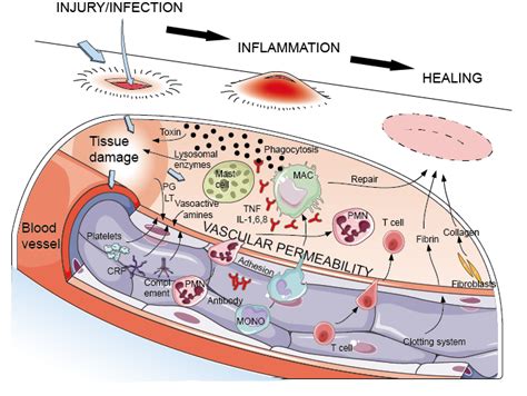 Acute Inflammation - Creative Diagnostics