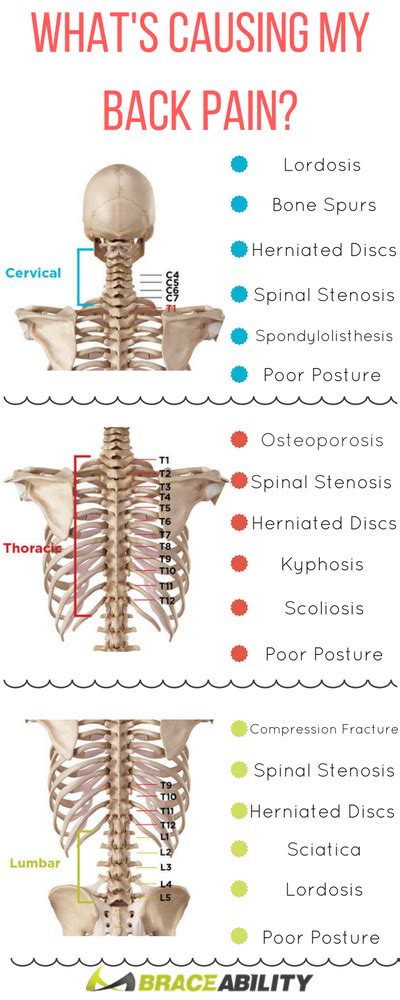 Pin on Back Injuries & Spine Disorders | What's Causing my Back Pain ...