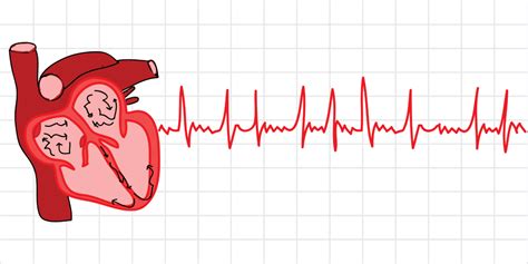 Understanding AFib: A heart dancing without rhythm - Scope