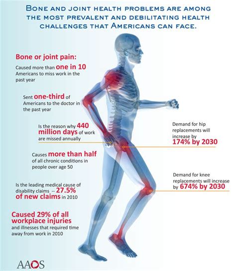 Causes Of Joint Pain And Foods That Relieve Joint Pain - Fitneass