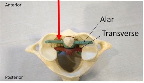 Transverse Ligament Cervical Spine