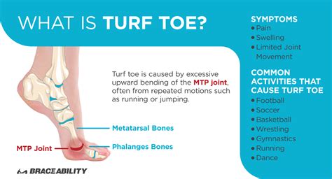 Turf Toe Brace | This Soft Splint Works Better than Taping