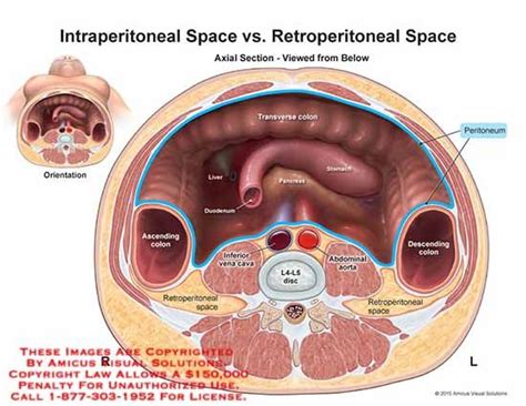 amicus,anatomy,heart,lung,superior,vena,cava,aorta,pulmonary,trunk,right,atrium,ventricle,left ...