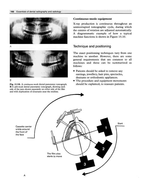 Essentials.of.Dental.Radiography.and.Radiology by Alejandro Padilla - Issuu