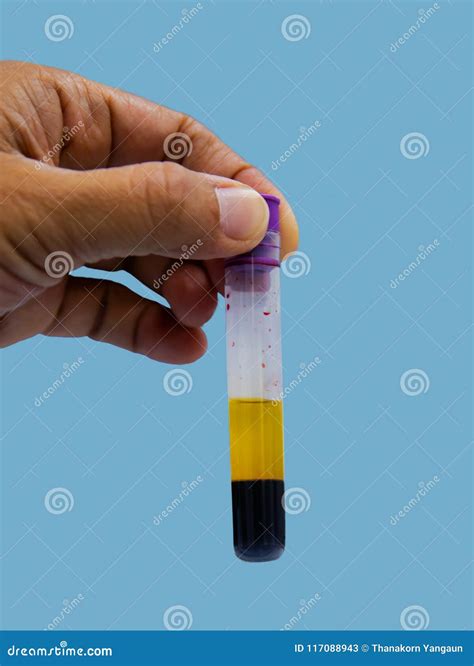 Close Up Blood Serum in Specimen Tube on Blue Background for Complete Blood Count Analysis ...