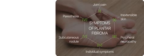 Plantar Fibroma Treatment, Symptoms, and Causes | Mega Aid