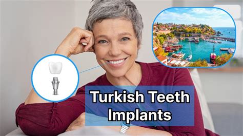 Turkish Teeth Implants Procedure and Price – FindGlob