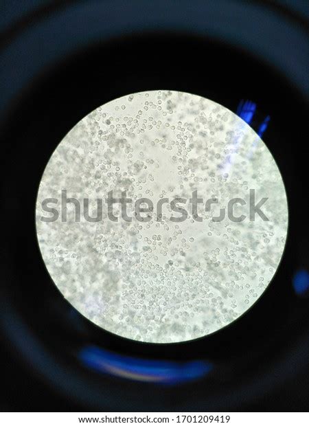 White Blood Cells Urine Stock Photo 1701209419 | Shutterstock