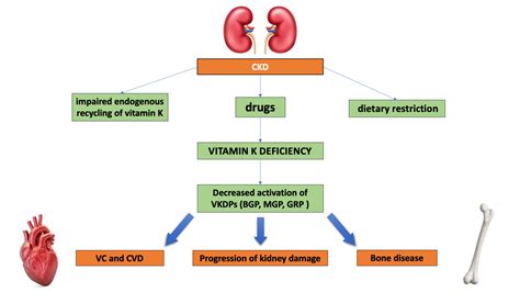 IJMS | Free Full-Text | Role of Vitamin K in Chronic Kidney Disease: A ...