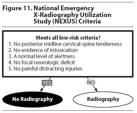 Guidelines | The Canadian C-Spine Rule V the NEXUS Low-Risk Criteria in ...