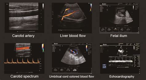 Best portable ultrasound manufacturers