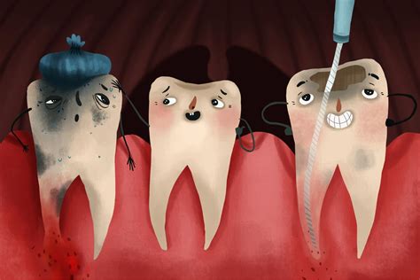 Stages of Tooth Decay & How to Prevent It | Riverstone Dental Care