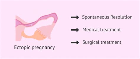 Treatment for Ectopic Pregnancy