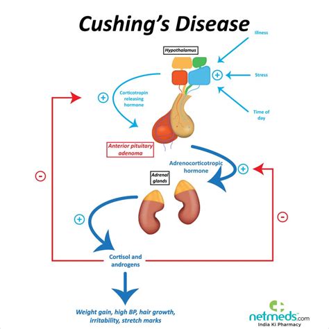 Cushing Disease