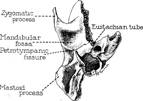 Petrotympanic Fissure Chorda Tympani