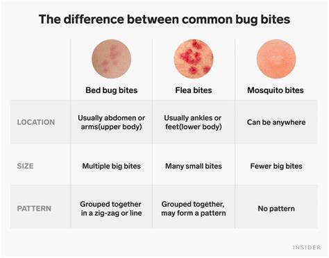 How Do You Get Rid Of Dog Flea Bites On Humans