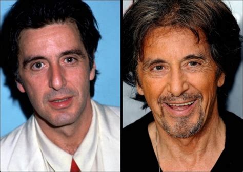 Al Pacino Plastic Surgery Before and After Botox Injections and Facelift - Star Plastic Surgery ...