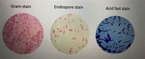 Solved Gram stain Endospore stain Acid fast stain | Chegg.com