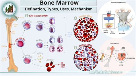 Bone Marrow: Function, Types, and Contribution to Immune System Function