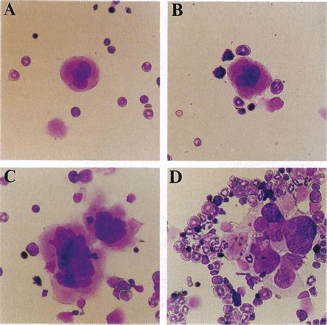 Megakaryocytes in transgenic and nontransgenic bone marrow. Bone marrow ...