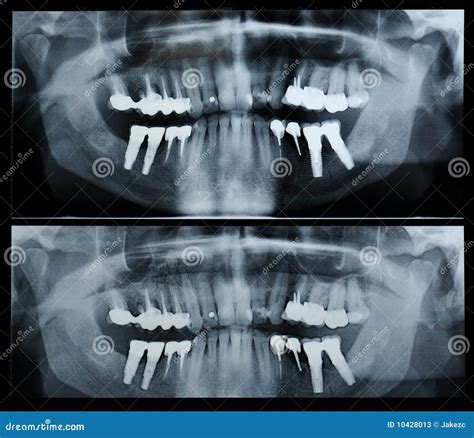 Dental Radiography Stock Photos - Image: 10428013