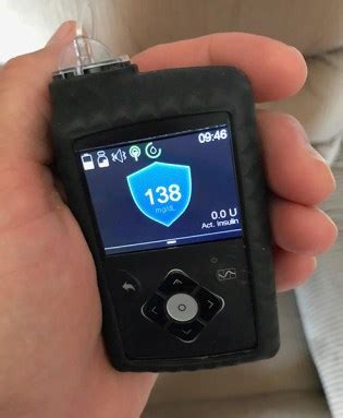 Diabetes Product Review: Medtronic 670G Hybrid Closed Loop