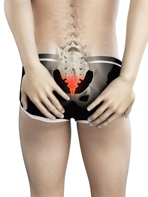 Tailbone Pain: What May Be Causing It? | Neurosurgery & Spine Consultants
