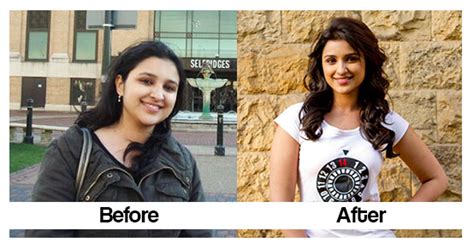 Parineeti Chopra Before And After