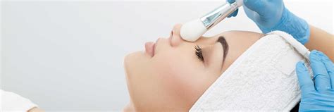 TCA Peel - McLean VA, Washington DC - BioLux Skin Care