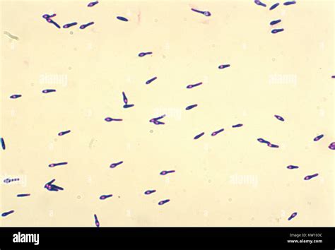 Clostridium Gram Stain