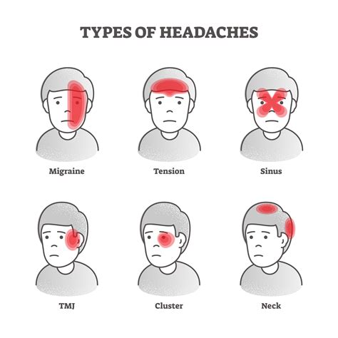 headaches - The Whitchurch Clinic