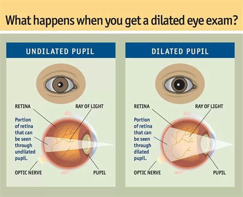 Undilated vs. Dilated pupil | Dilated pupils, Eye exam, Eye facts